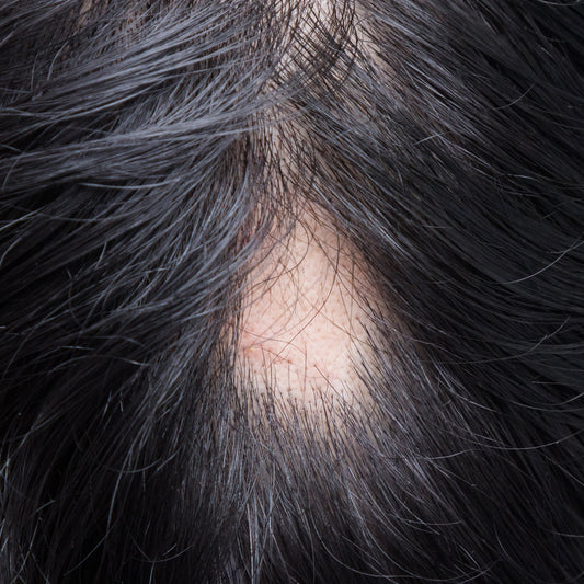 Wenn Haare älter werden – was sie jetzt wirklich brauchen